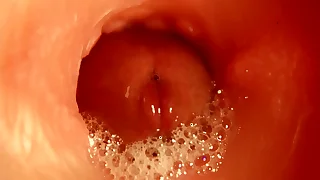 Tall Cumshot inside HOLE&excl; BEST CUMSHOT INSIDE ANAL&excl; ASMR